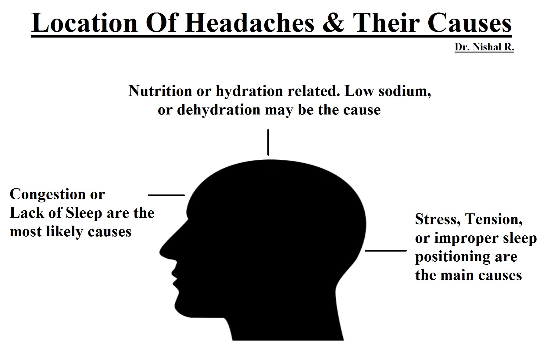 Headache Remedies (EvidenceBased) Dr. Nishal R.